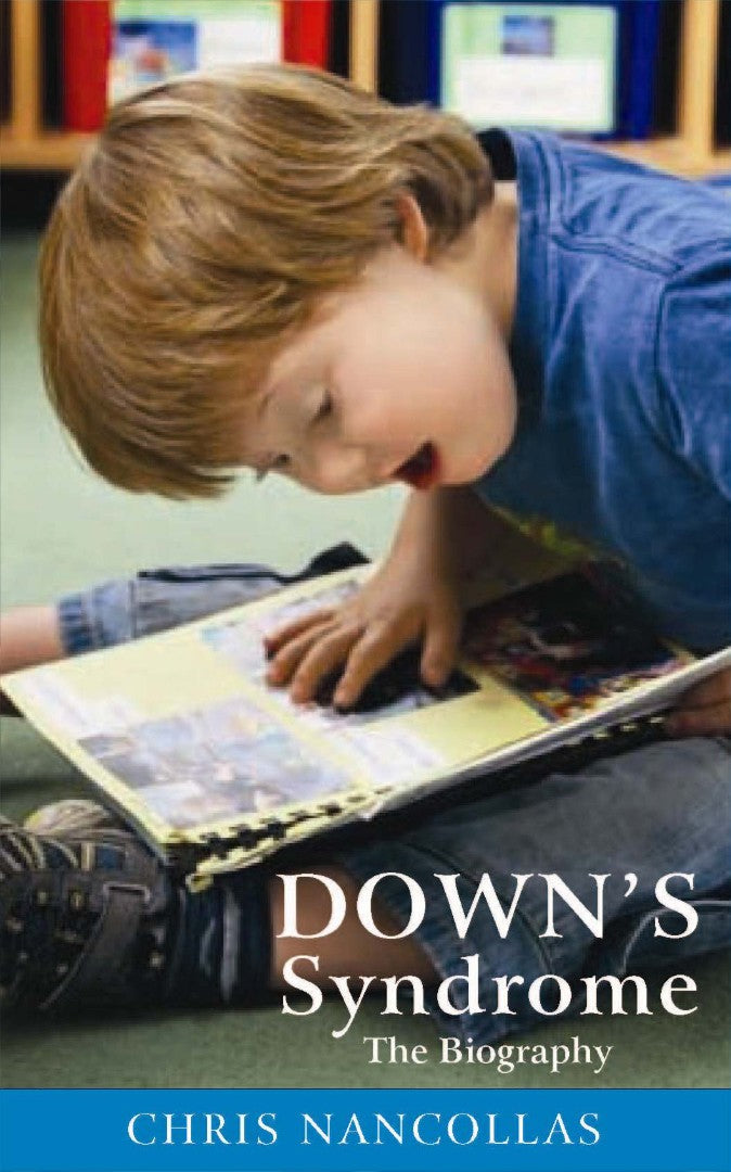 Down's Syndrome - Re-vived